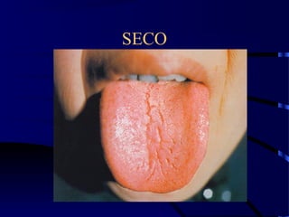 SECO
 