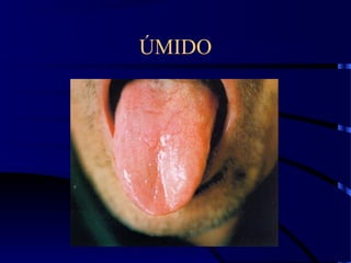 ÚMIDO
 