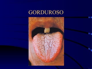GORDUROSO
 