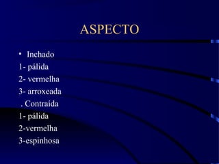ASPECTO
• Inchado
1- pálida
2- vermelha
3- arroxeada
. Contraída
1- pálida
2-vermelha
3-espinhosa
 