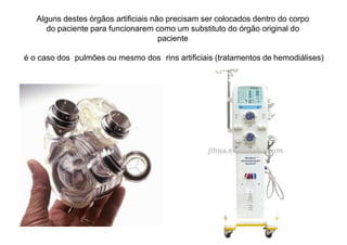 Alguns destes órgãos artificiais não precisam ser colocados dentro do corpo
do paciente para funcionarem como um substituto do órgão original do
paciente
é o caso dos pulmões ou mesmo dos rins artificiais (tratamentos de hemodiálises)
 