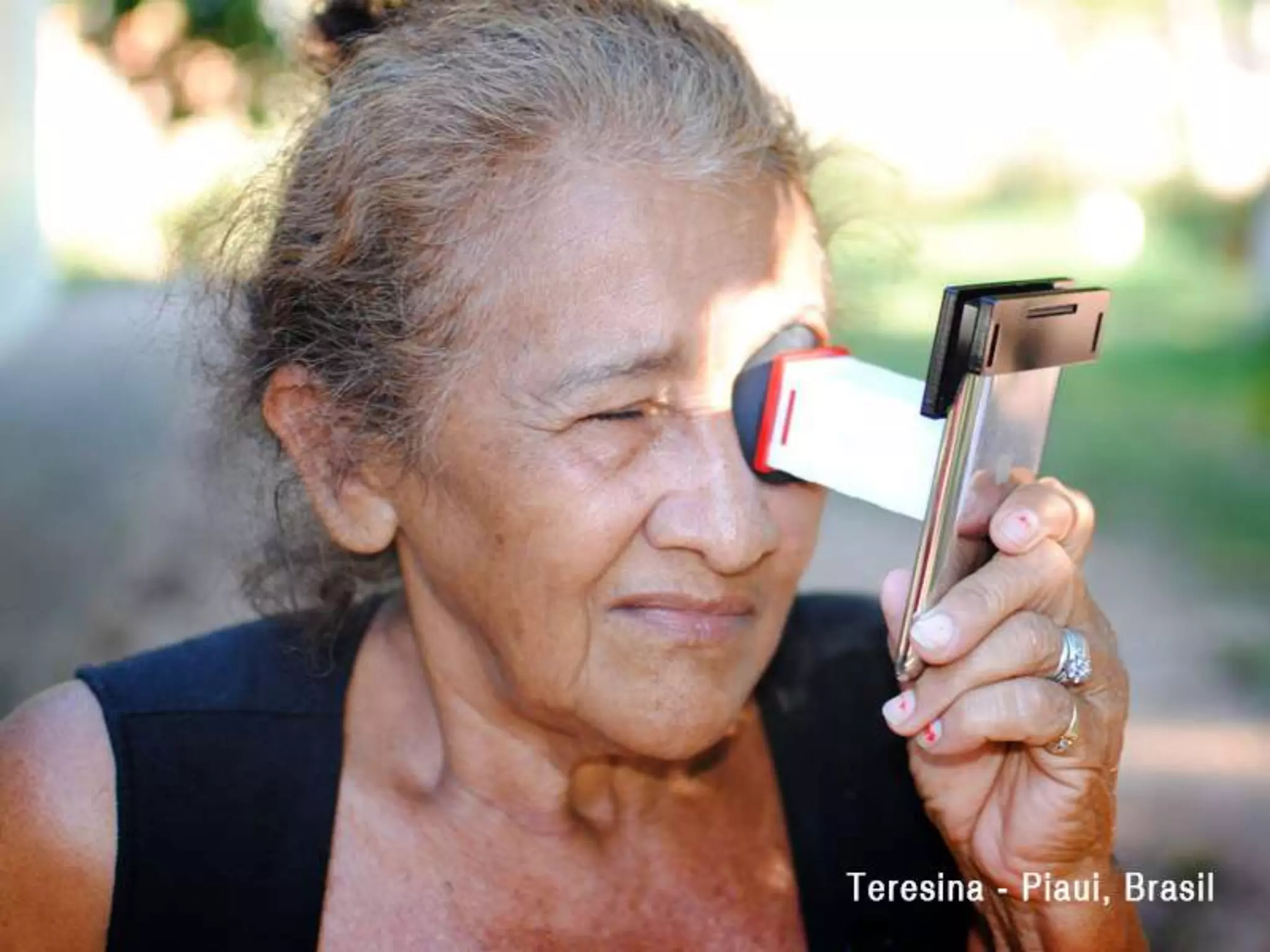 Netra, a câmera oftalmológica