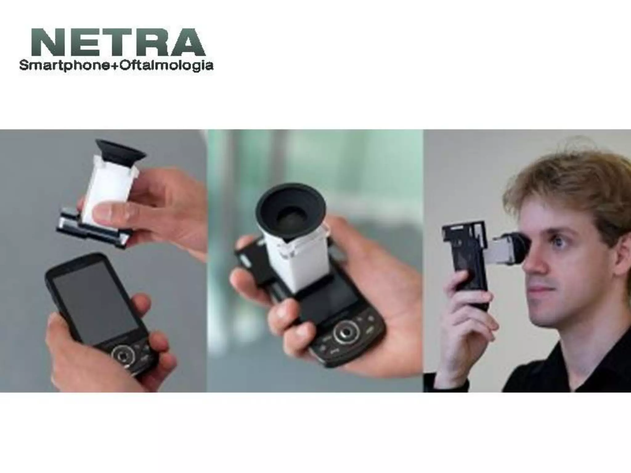 Netra, a câmera oftalmológica