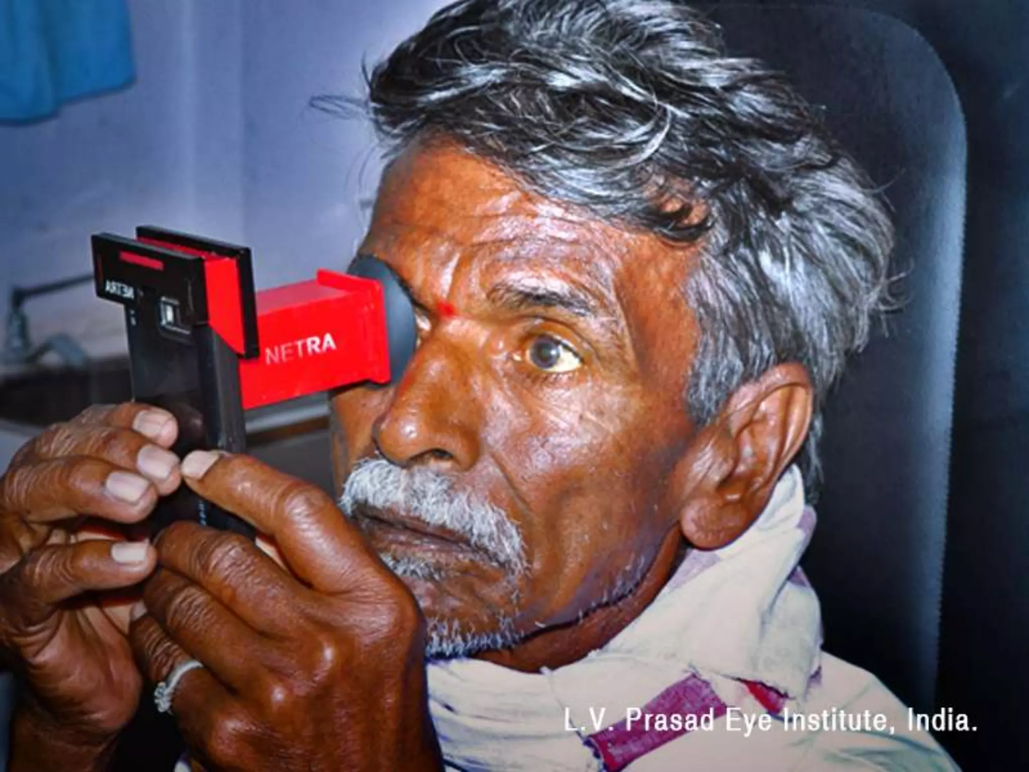 Netra, a câmera oftalmológica