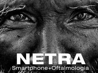 Netra, a câmera oftalmológica