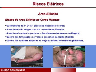 Riscos Elétricos

                                 Arco Elétrico
  Efeitos do Arco Elétrico no Corpo Humano

  • Queimaduras de 1°, 2° e 3° graus nos músculos do corpo;
  • Aquecimento do sangue com sua conseqüente dilatação;
  • Aquecimento podendo provocar o derretimento dos ossos e cartilagens;
  • Queima das terminações nervosas e sensoriais da região atingida;
  • Queima das camadas adiposas ao longo da derme, tornando-as gelatinosas.




CURSO BÁSICO NR10
 