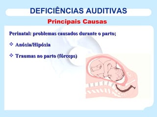 DEFICIÊNCIAS AUDITIVAS Principais Causas Perinatal: problemas causados durante o parto; Anóxia/Hipóxia Traumas no parto (fórceps) 