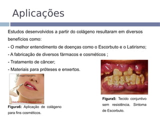 Aplicações
Estudos desenvolvidos a partir do colágeno resultaram em diversos
benefícios como:
- O melhor entendimento de doenças como o Escorbuto e o Latirismo;
- A fabricação de diversos fármacos e cosméticos ;
- Tratamento de câncer;
- Materiais para próteses e enxertos.




                                               Figura5: Tecido conjuntivo
                                               sem resistência. Sintoma
Figura6: Aplicação de colágeno
                                               de Escorbuto.
para fins cosméticos.
 