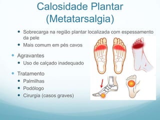 Calosidade Plantar(Metatarsalgia)Sobrecarga na região plantar localizada com espessamento da peleMais comum em pés cavosAgravantesUso de calçado inadequadoTratamentoPalmilhasPodólogoCirurgia (casos graves)