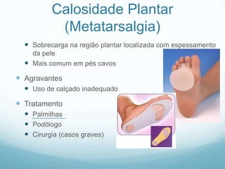 Calosidade Plantar(Metatarsalgia)Sobrecarga na região plantar localizada com espessamento da peleMais comum em pés cavosAgravantesUso de calçado inadequadoTratamentoPalmilhasPodólogoCirurgia (casos graves)