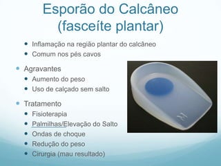 Esporão do Calcâneo (fasceíte plantar)Inflamação na região plantar do calcâneoComum nos pés cavosAgravantesAumento do pesoUso de calçado sem saltoTratamentoFisioterapiaPalmilhas/Elevação do SaltoOndas de choqueRedução do pesoCirurgia (mau resultado)