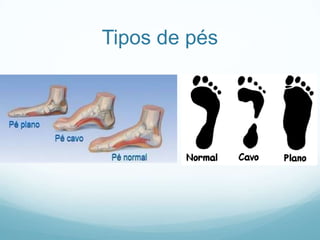 Tipos de pés
