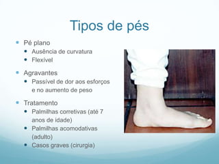 Tipos de pésPé planoAusência de curvaturaFlexívelAgravantesPassível de dor aos esforços	e no aumento de pesoTratamentoPalmilhas corretivas (até 7	anos de idade)Palmilhas acomodativas	(adulto)Casos graves (cirurgia)
