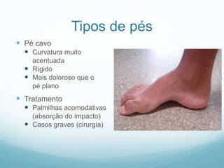 Tipos de pésPé cavoCurvatura muito	acentuadaRígidoMais doloroso que o	pé planoTratamentoPalmilhas acomodativas	(absorção do impacto)Casos graves (cirurgia)