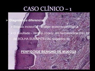 CASO CLÍNICO - 1 História da Doença atual: 