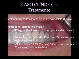 Alterações na mucosa gengival - 3 anos atrás, 