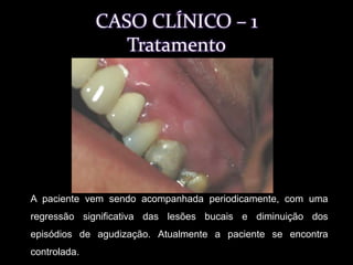 Realizado exames de imunofluorescência indireta. 