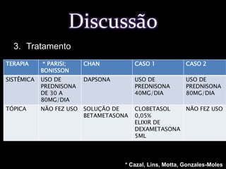 Clobetasol a 0,05% (Psorex) 03 vezes ao dia, por 20 minutos, uso da moldeiraCASO CLÍNICO – 1Tratamento
