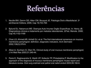 Clobetasol a 0,05% (Psorex) 03 a 04 vezes ao dia, durante 20 minutos