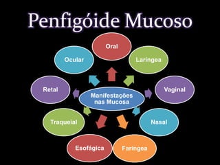 Penfigóide Mucoso