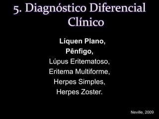 5. Diagnóstico DiferencialClínico   Líquen Plano, Pênfigo,Lúpus Eritematoso, Eritema Multiforme, Herpes Simples, Herpes Zoster.Neville, 2009