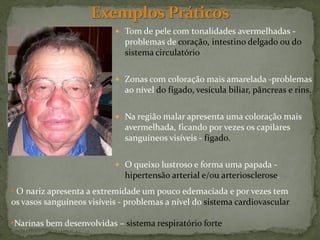  Tom de pele com tonalidades avermelhadas -
                              problemas de coração, intestino delgado ou do
                              sistema circulatório


                            Zonas com coloração mais amarelada -problemas
                              ao nível do fígado, vesícula biliar, pâncreas e rins.


                            Na região malar apresenta uma coloração mais
                              avermelhada, ficando por vezes os capilares
                              sanguíneos visíveis - fígado.


                            O queixo lustroso e forma uma papada -
                              hipertensão arterial e/ou arteriosclerose.
• O nariz apresenta a extremidade um pouco edemaciada e por vezes tem
os vasos sanguíneos visíveis - problemas a nível do sistema cardiovascular

•Narinas bem desenvolvidas – sistema respiratório forte
 