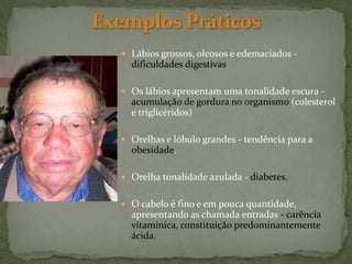  Lábios grossos, oleosos e edemaciados -
  dificuldades digestivas

 Os lábios apresentam uma tonalidade escura -
  acumulação de gordura no organismo (colesterol
  e triglicéridos)

 Orelhas e lóbulo grandes - tendência para a
  obesidade.

 Orelha tonalidade azulada - diabetes.


 O cabelo é fino e em pouca quantidade,
  apresentando as chamada entradas - carência
  vitamínica, constituição predominantemente
  ácida.
 