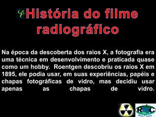 Na época da descoberta dos raios X, a fotografia era
uma técnica em desenvolvimento e praticada quase
como um hobby. Roentgen descobriu os raios X em
1895, ele podia usar, em suas experiências, papéis e
chapas fotográficas de vidro, mas decidiu usar
apenas as chapas de vidro.
 