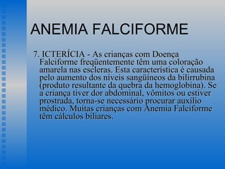 ANEMIA FALCIFORME 7. ICTERÍCIA - As crianças com Doença Falciforme freqüentemente têm uma coloração amarela nas escleras. Esta característica é causada pelo aumento dos níveis sangüíneos da bilirrubina (produto resultante da quebra da hemoglobina). Se a criança tiver dor abdominal, vômitos ou estiver prostrada, torna-se necessário procurar auxílio médico. Muitas crianças com Anemia Falciforme têm cálculos biliares.  