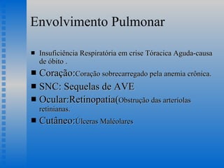 Envolvimento Pulmonar Insuficiência Respiratória em crise Tóracica Aguda-causa de óbito . Coração: Coração sobrecarregado pela anemia crônica. SNC: Sequelas de AVE Ocular:Retinopatia( Obstrução das arteríolas retinianas. Cutâneo: Úlceras Maléolares 