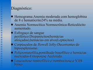 Diagnóstico: Hemograma:Anemia moderada com hemoglobina de 8 e hematócrito24% na média. Anemia Normocítica Normocrônica-Reticulócito aumentado. Esfregaço de sangue periférico:Drepanócitos(hemácias afoiçadas),hemácias em alvo(Leptócitos) Corpúsculos de Jlowell Jolly-Decorrentes do hipoesplenismo. Policromatofilia,pontilhado basofílico e hemácias nucleadas-Eritopoiese Acelerada. Leucocitose neutrofílica e trombocitose,e VHS baixo. 