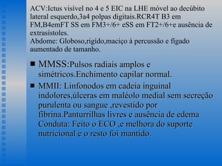 ACV:Ictus visível no 4 e 5 EIC na LHE móvel ao decúbito lateral esquerdo,3a4 polpas digitais.RCR4T B3 em FM,B4emFT SS em FM3+/6+ eSS em FT2+/6+e ausência de extrasístoles. Abdome: Globoso,rigído,maciço à percussão e fígado aumentado de tamanho. MMSS: Pulsos radiais amplos e simétricos.Enchimento capilar normal. MMII: Linfonodos em cadeia inguinal indolores,úlceras em maléolo medial sem secreção purulenta ou sangue ,revestido por fibrina.Panturrilhas livres e ausência de edema Conduta: Feito o ECO ,e melhora do suporte nutricional e o resto foi mantido.  
