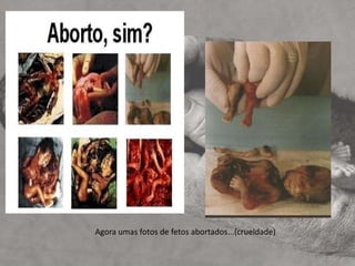  para preservar a saúde física ou mental da mulher[3]