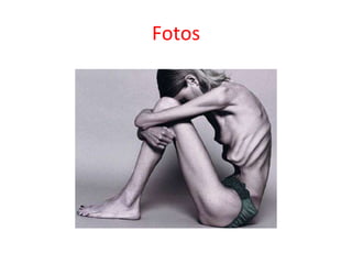 Fotos 