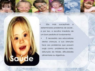 Trissomia 21por translocação