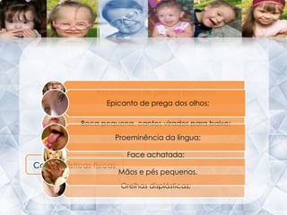  Existem 47 cromossomas;