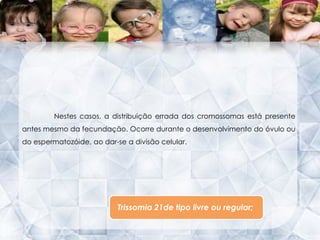  Daí o facto desta situação ser chamada de         Trissomia 21.Trissomia 21Características Características físicasCaracterísticas mentais