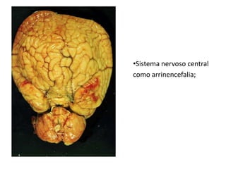 Expectativa de vida é muito curta (cerca de seis meses). 