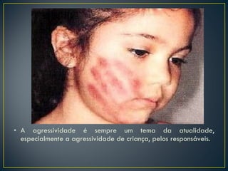 A agressividade é sempre um tema da atualidade, especialmente a agressividade de criança, pelos responsáveis. 