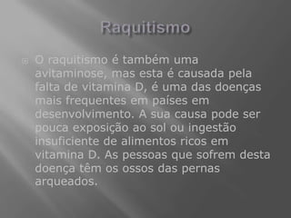    O raquitismo é também uma
    avitaminose, mas esta é causada pela
    falta de vitamina D, é uma das doenças
    mais frequentes em países em
    desenvolvimento. A sua causa pode ser
    pouca exposição ao sol ou ingestão
    insuficiente de alimentos ricos em
    vitamina D. As pessoas que sofrem desta
    doença têm os ossos das pernas
    arqueados.
 