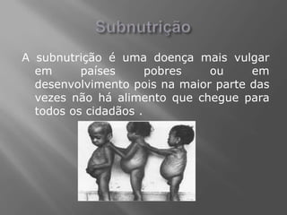 A subnutrição é uma doença mais vulgar
  em      países      pobres   ou     em
  desenvolvimento pois na maior parte das
  vezes não há alimento que chegue para
  todos os cidadãos .
 