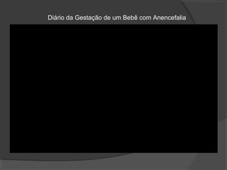 Diário da Gestação de um Bebê com Anencefalia
 