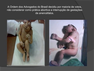 A Ordem dos Advogados do Brasil decidiu por maioria de votos,
não considerar como prática abortiva a interrupção de gestações
                       de anencéfalos.
 