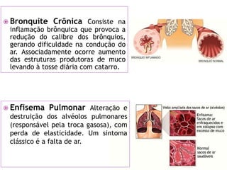  Bronquite    Crônica Consiste na
 inflamação brônquica que provoca a
 redução do calibre dos brônquios,
 gerando dificuldade na condução do
 ar. Associadamente ocorre aumento
 das estruturas produtoras de muco
 levando à tosse diária com catarro.




 Enfisema    Pulmonar Alteração e
 destruição dos alvéolos pulmonares
 (responsável pela troca gasosa), com
 perda de elasticidade. Um sintoma
 clássico é a falta de ar.
 