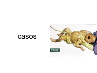 casos 