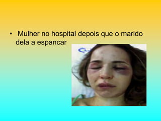 • Mulher no hospital depois que o marido
dela a espancar
 