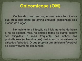 Conhecida como micose, é uma infecção micótica
que afeta toda parte da lâmina ungueal, ocasionada pelo
ataque de fungos.
Normalmente a infecção se inicia na unha do hálux
e na do polegar, mas, no entanto todas as outras podem
ser atingidas; é mais frequente nas unhas dos
pododáctolos (unhas dos pés) devido ao uso constante de
calçados fechados. O que propicia um ambiente favorável
ao desenvolvimento dos fungos.

 