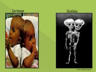 Cariópago

Dicéfalos

Fonte: Google Imagens

 