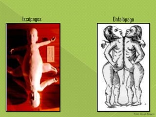 Iscópagos

Onfalópago

Fonte: Google Imagens

 