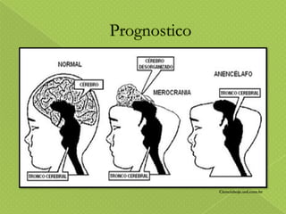 Cienciahoje.uol.com.br

 